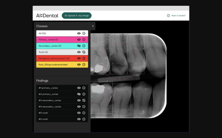 AIDental-image-obr-na-web-1